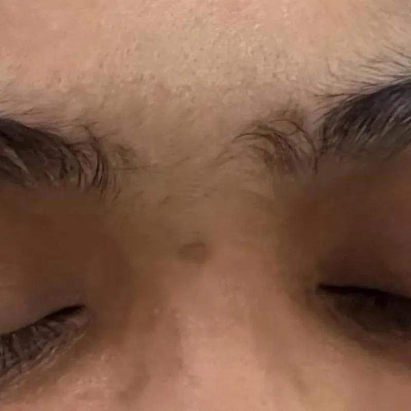 Eyebrow After